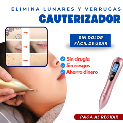 🔥 Elimina imperfecciones al instante con el cauterizador - ORIGINAL ⭐️⭐️⭐️⭐️⭐️